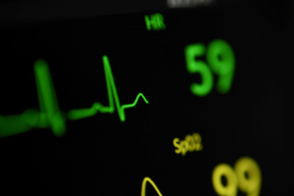 how can I help EKG technicians avoid burnout